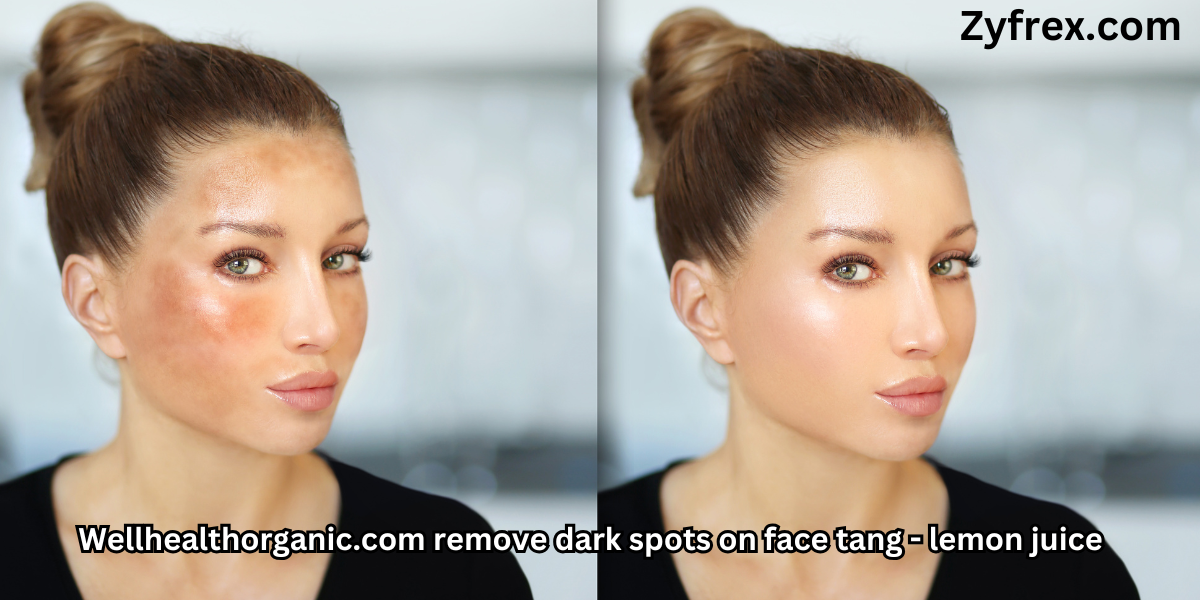 Wellhealthorganic.com remove dark spots on face tang - lemon juice